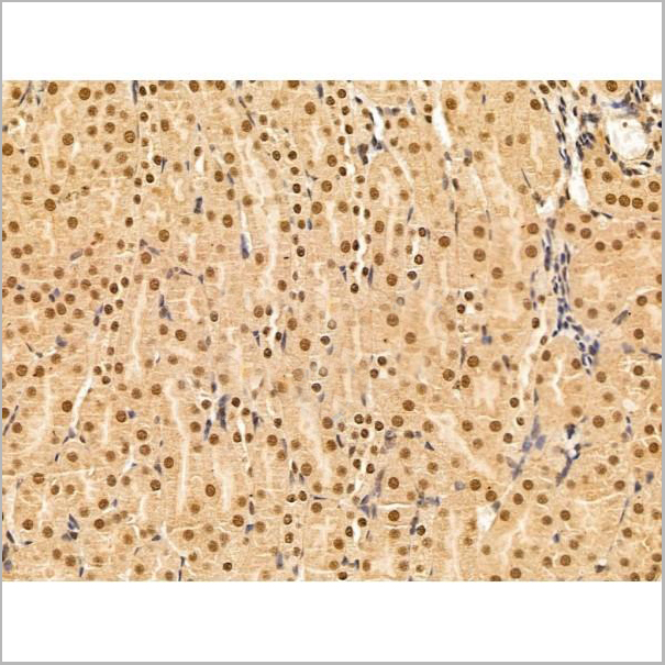 product-image-AAA31266_IHC6.jpg