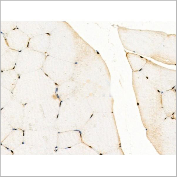 product-image-AAA31268_IHC2.jpg