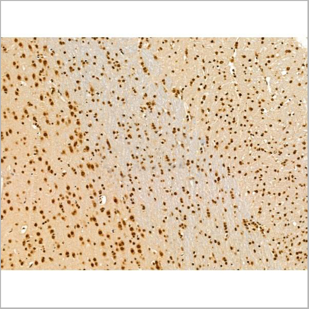 product-image-AAA31268_IHC3.jpg