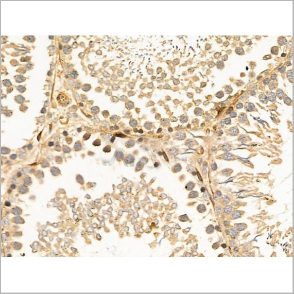 product-image-AAA31269_IHC4.jpg