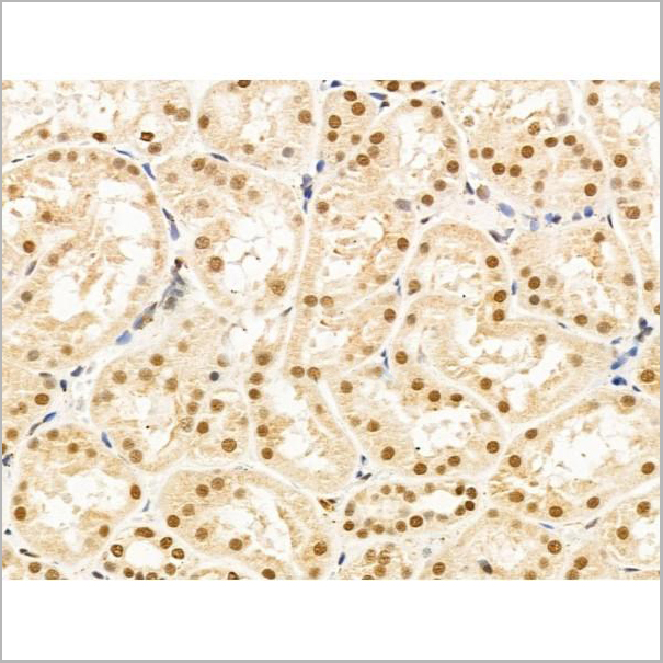 product-image-AAA31270_IHC3.jpg