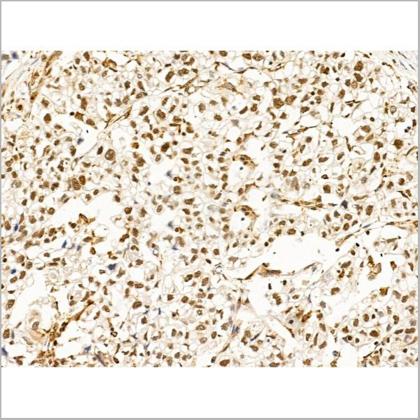 product-image-AAA31270_IHC4.jpg