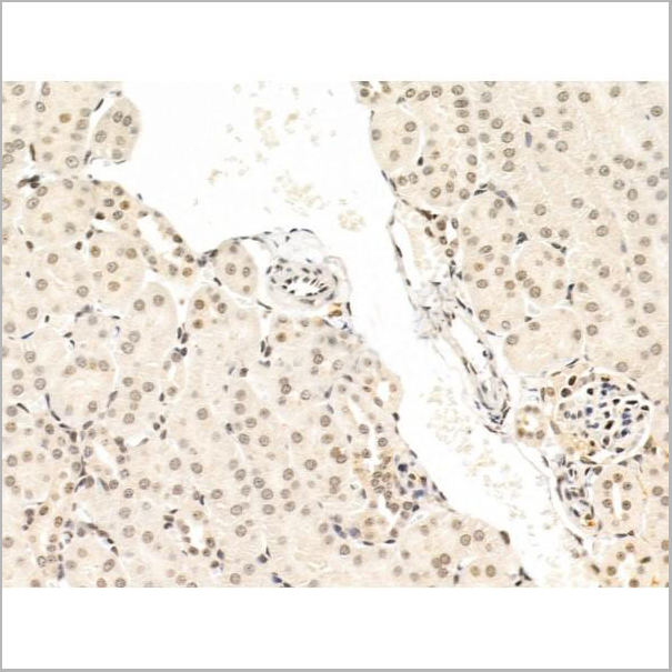 product-image-AAA31271_IHC4.jpg
