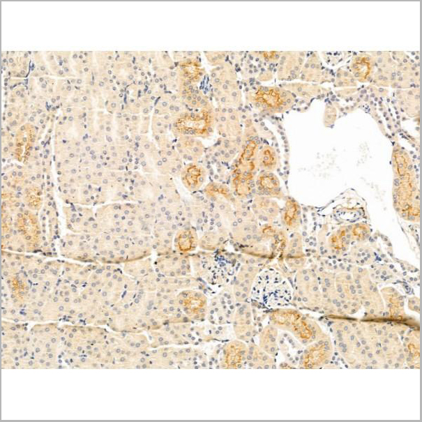 product-image-AAA31272_IHC4.jpg