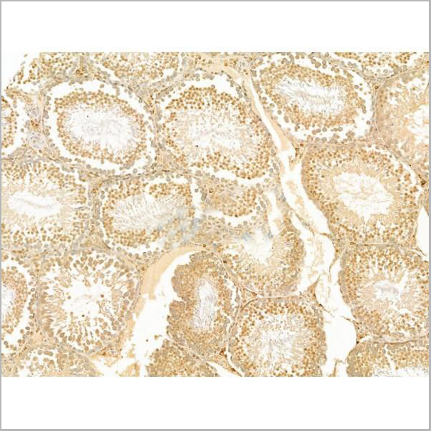 product-image-AAA31273_IHC2.jpg