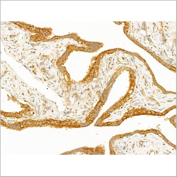 product-image-AAA31273_IHC4.jpg