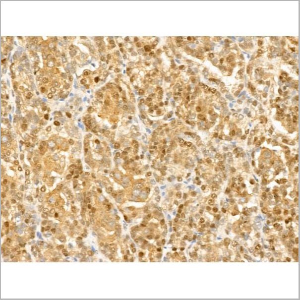 product-image-AAA31273_IHC5.jpg