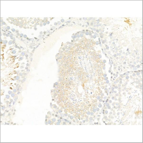 product-image-AAA31274_IHC3.jpg