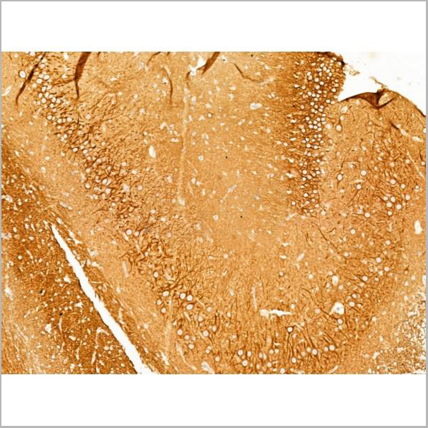 product-image-AAA31274_IHC4.jpg