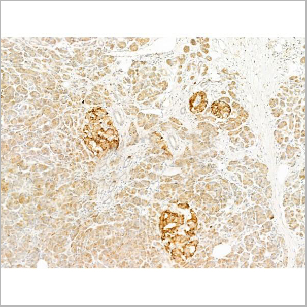 product-image-AAA31274_IHC7.jpg