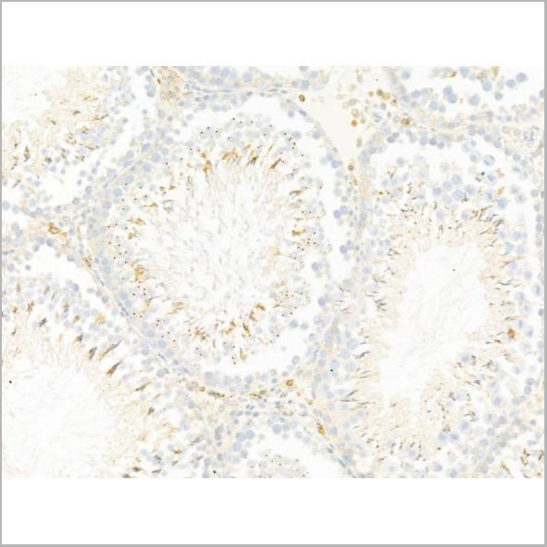 product-image-AAA31275_IHC2.jpg