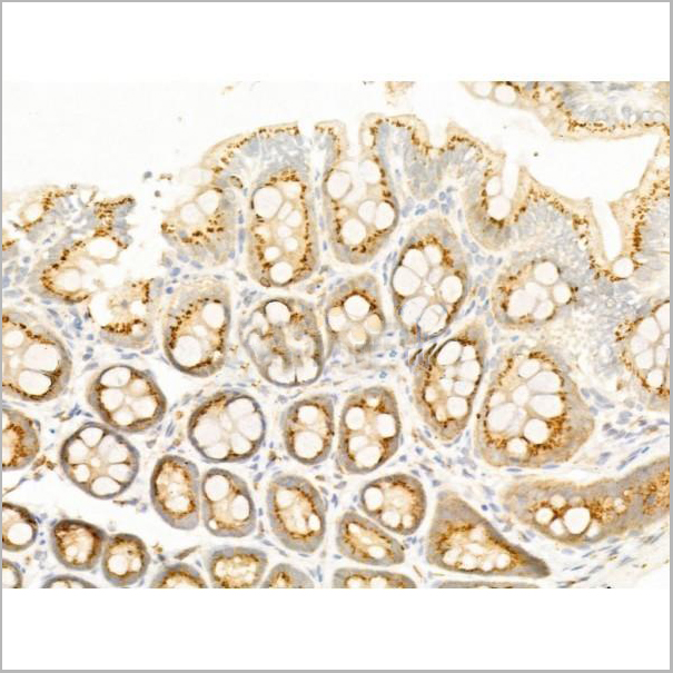 product-image-AAA31275_IHC3.jpg