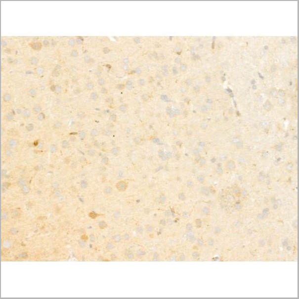 product-image-AAA31275_IHC4.jpg
