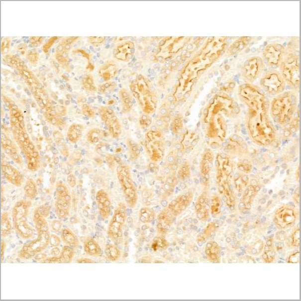 product-image-AAA31275_IHC5.jpg