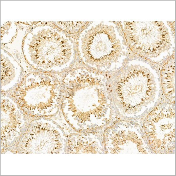 product-image-AAA31276_IHC3.jpg