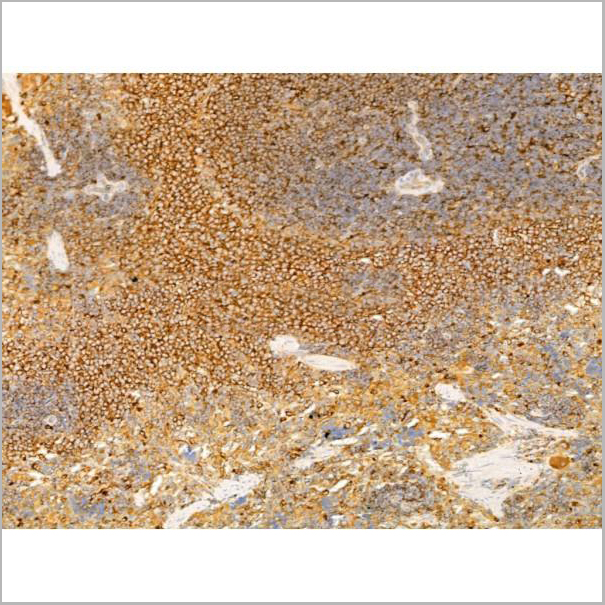 product-image-AAA31276_IHC5.jpg
