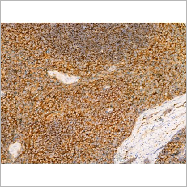 product-image-AAA31276_IHC7.jpg