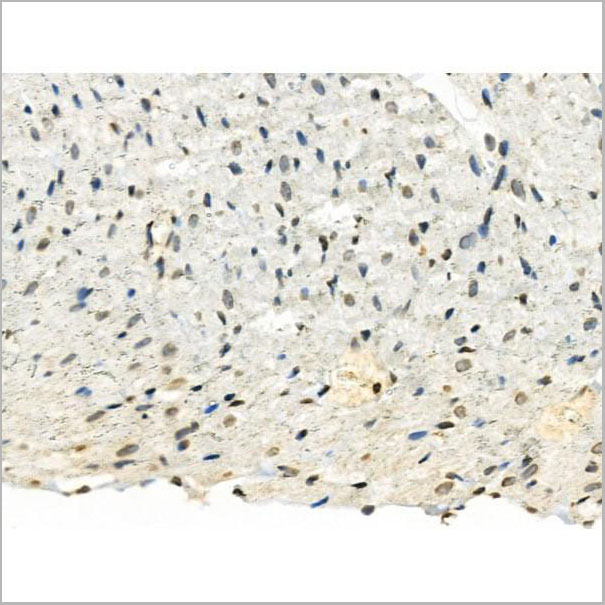 product-image-AAA31280_IHC.jpg