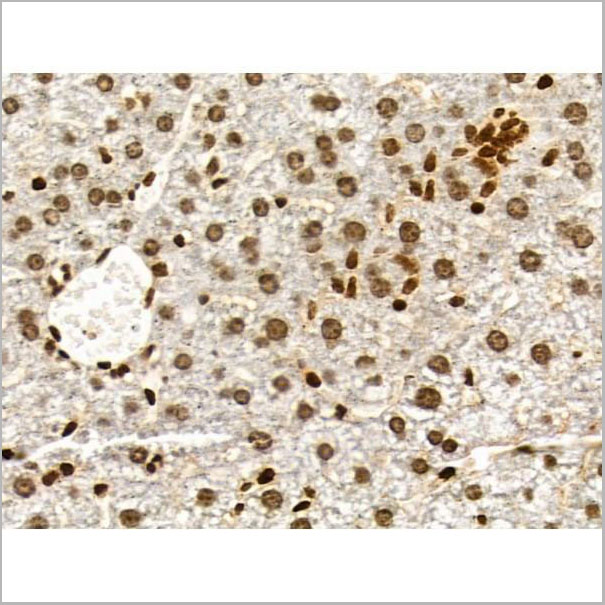 product-image-AAA31280_IHC2.jpg