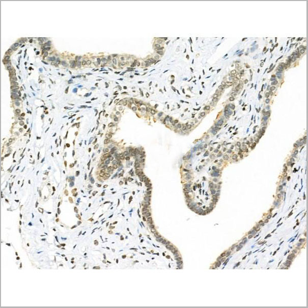 product-image-AAA31280_IHC5.jpg