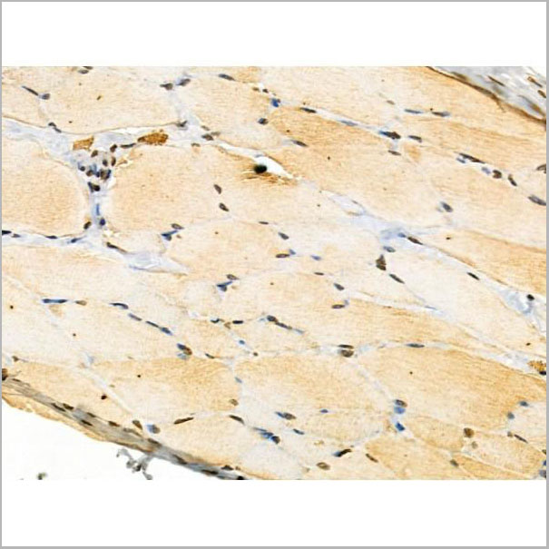 product-image-AAA31292_IHC.jpg