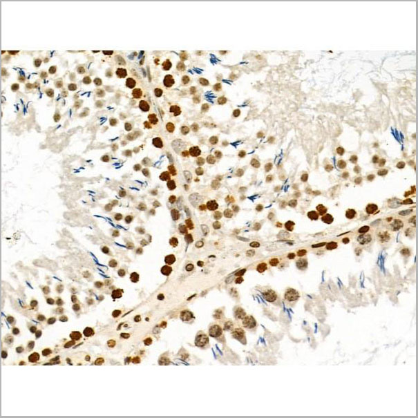 product-image-AAA31292_IHC2.jpg