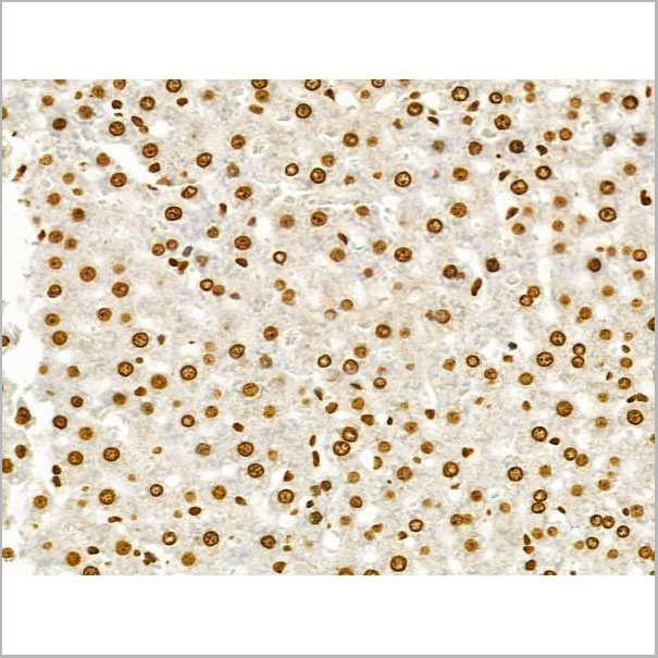 product-image-AAA31292_IHC3.jpg