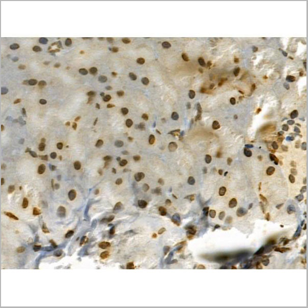 product-image-AAA31292_IHC5.jpg