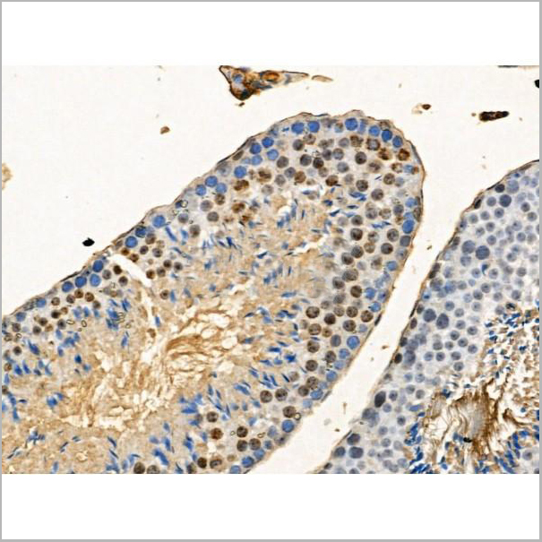 product-image-AAA31301_IHC2.jpg