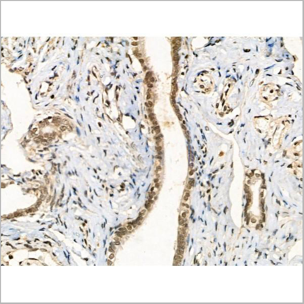 product-image-AAA31301_IHC3.jpg