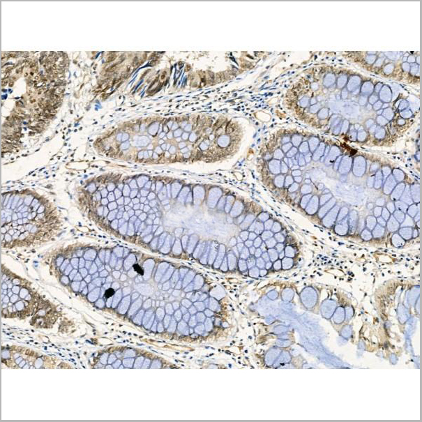 product-image-AAA31301_IHC4.jpg