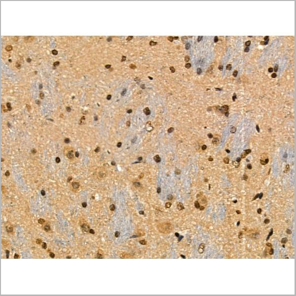 product-image-AAA31330_IHC2.jpg