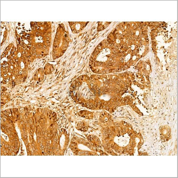 product-image-AAA31336_IHC2.jpg