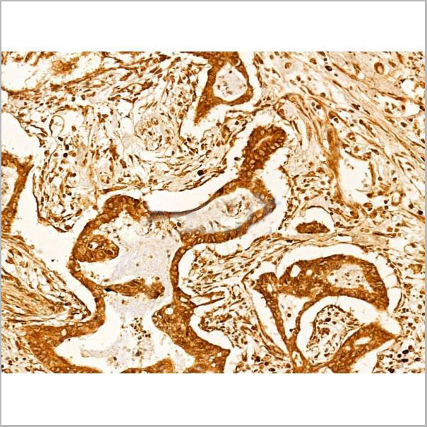 product-image-AAA31336_IHC4.jpg