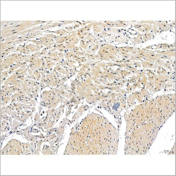 product-image-AAA31338_IHC10.jpg