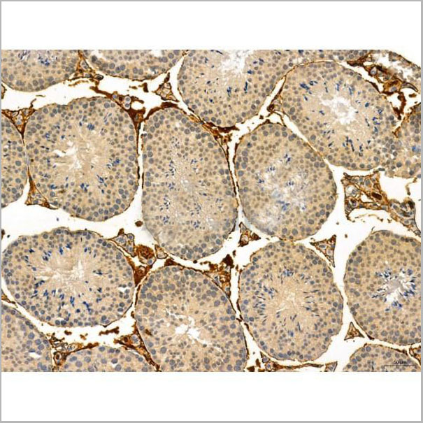 product-image-AAA31338_IHC12.jpg