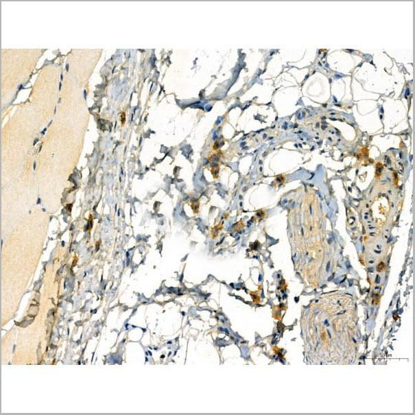 product-image-AAA31338_IHC13.jpg
