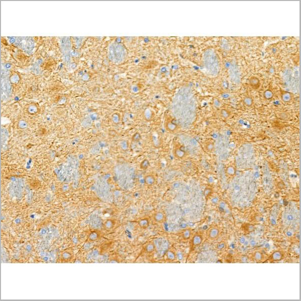 product-image-AAA31338_IHC3.jpg