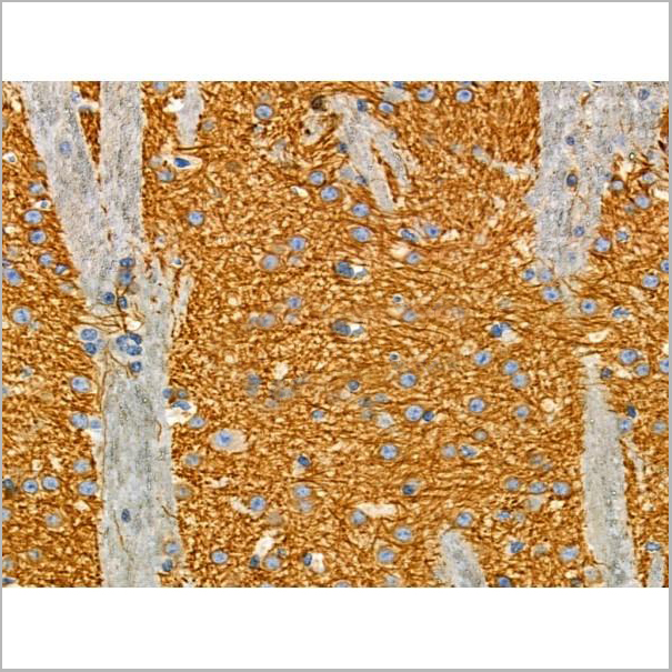 product-image-AAA31338_IHC4.jpg