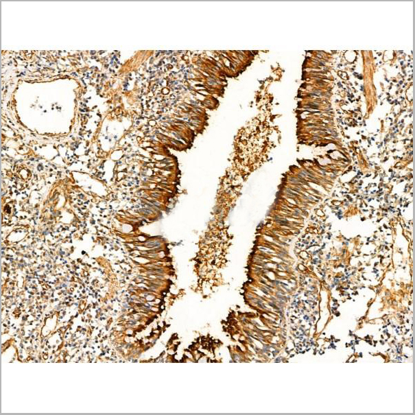 product-image-AAA31344_IHC4.jpg