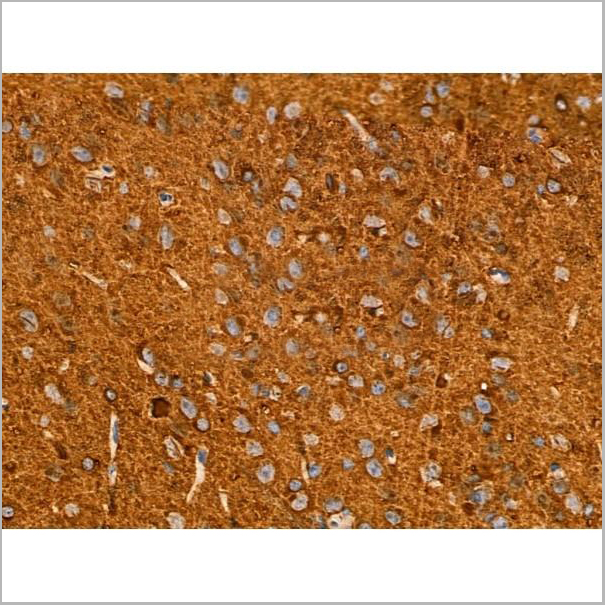 product-image-AAA31344_IHC5.jpg