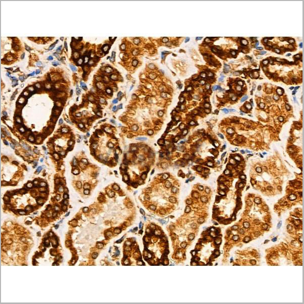 product-image-AAA31344_IHC7.jpg