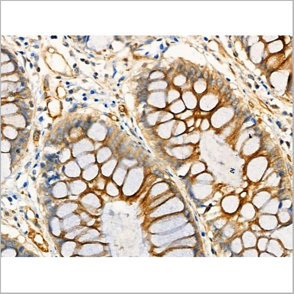 product-image-AAA31344_IHC9.jpg
