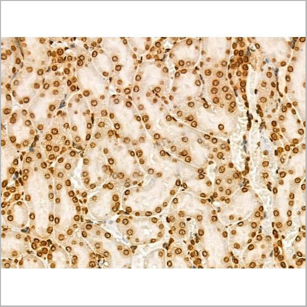product-image-AAA31352_IHC11.jpg
