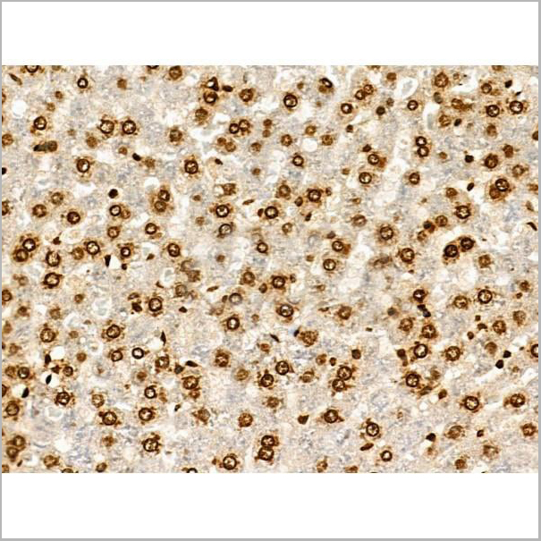 product-image-AAA31352_IHC12.jpg
