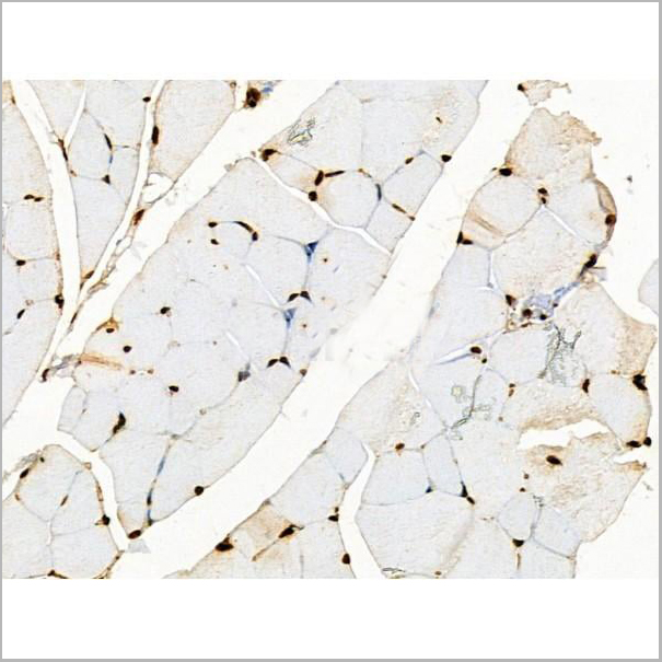 product-image-AAA31352_IHC14.jpg