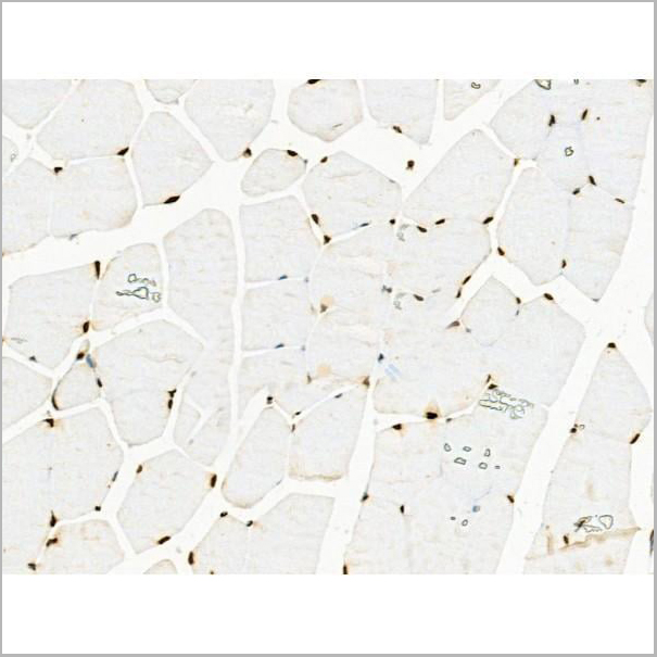 product-image-AAA31352_IHC15.jpg