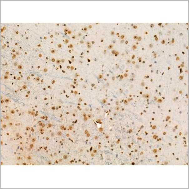 product-image-AAA31352_IHC18.jpg