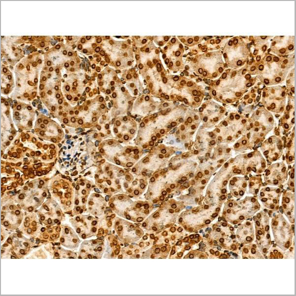 product-image-AAA31352_IHC19.jpg