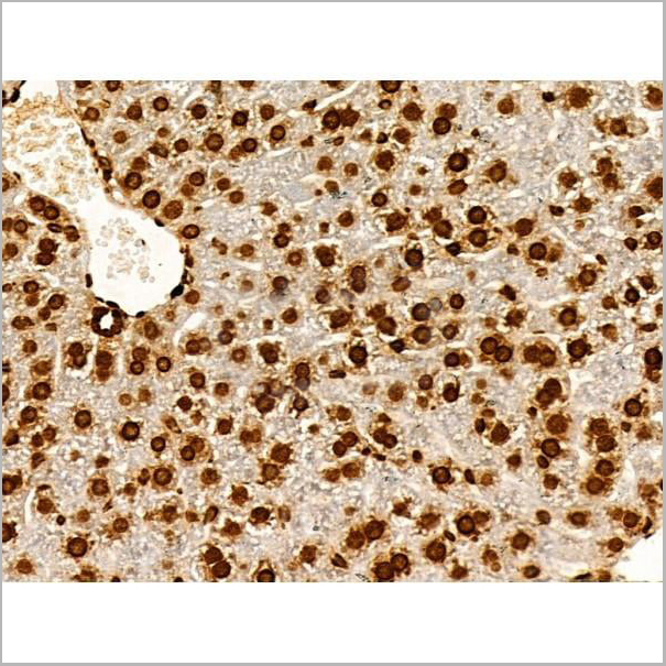 product-image-AAA31352_IHC20.jpg